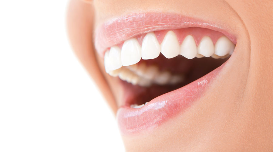 Implantes dentales Santo Domingo